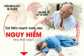 Cách phòng ngừa đột quỵ não ngay tại nhà ai cũng nên biết