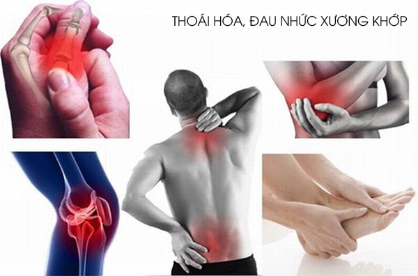 nhung vi tri hay bi dau nhuc xuong khop