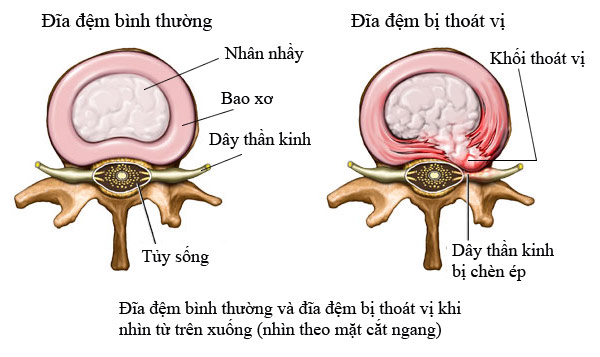Thoat vi dia dem - 1
